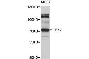 Western blot analysis of extract of MCF7 cells, using TBX2 antibody. (TBX2 antibody)