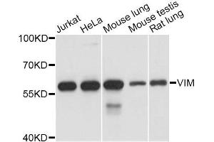 Western blot analysis of extracts of various cell lines, using VIM antibody. (Vimentin antibody  (AA 1-101))