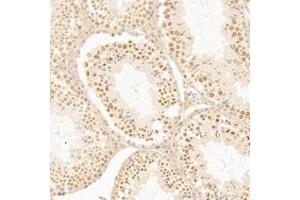 Immunohistochemistry analysis of paraffin-embedded mouse testis using,AF10 (ABIN7075234) at dilution of 1: 1200 (MLLT10 antibody)