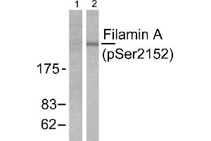 Western blot analysis of extracts from 293 cells treated with EGF (200ng/ml, 5mins), using Filamin A (phospho-Ser2152) antibody. (Filamin A antibody  (pSer2152))