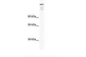 Image no. 1 for anti-Zinc Finger Protein 106 Homolog (ZFP106) (AA 649-698) antibody (ABIN6736024) (ZFP106 antibody  (AA 649-698))