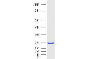 Validation with Western Blot