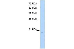 Western Blot showing RGS8 antibody used at a concentration of 1-2 ug/ml to detect its target protein. (RGS8 antibody  (N-Term))