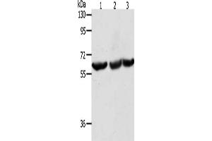 Gel: 8 % SDS-PAGE, Lysate: 40 μg, Lane 1-3: Jurkat cells, PC3 cells, Lovo cells, Primary antibody: ABIN7131482(TRIM32 Antibody) at dilution 1/300, Secondary antibody: Goat anti rabbit IgG at 1/8000 dilution, Exposure time: 30 seconds (TRIM32 antibody)
