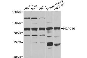 Western blot analysis of extracts of various cell lines, using HDAC10 antibody (ABIN5975007) at 1/1000 dilution. (HDAC10 antibody)