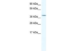 WB Suggested Anti-ISL2 Antibody Titration:  5. (ISL2 antibody  (C-Term))