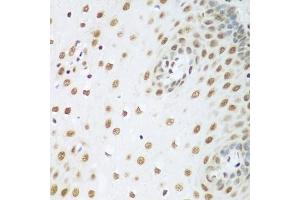 Immunohistochemistry of paraffin-embedded human esophagus using HDAC1 antibody (ABIN5970068) at dilution of 1/100 (40x lens). (HDAC1 antibody  (N-Term))