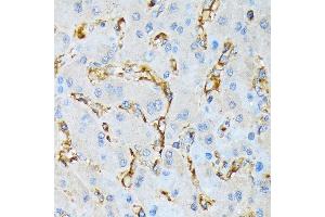 Immunohistochemistry of paraffin-embedded human liver using IQG Rabbit mAb (ABIN7268019) at dilution of 1:100 (40x lens). (IQGAP1 antibody)