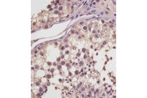 (ABIN6244040 and ABIN6578881) staining MGEA5 in human testis tissue sections by Immunohistochemistry (IHC-P - paraformaldehyde-fixed, paraffin-embedded sections). (MGEA5 antibody  (AA 236-269))
