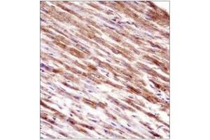 Immunohistochemistry analysis in formalin fixed and paraffin embedded human heart tissue reacted with HSPBP1 Antibody (N-term) followed which was peroxidase conjugated to the secondary antibody and  followed by DAB staining. (HSPBP1 antibody  (N-Term))
