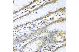 Immunohistochemistry of paraffin-embedded human stomach using PDIA3 antibody at dilution of 1:100 (40x lens). (PDIA3 antibody)