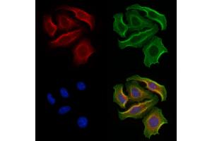 ABIN7094373 and ABIN7098420 staining Hela cells by IF/ICC. (MYH10 antibody  (C-Term))