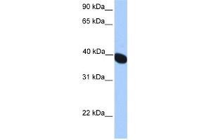 WB Suggested Anti-NEURL2 Antibody Titration: 0. (NEURL2 antibody  (N-Term))