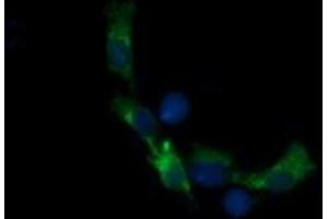 Image no. 3 for anti-Retinoic Acid Receptor Responder (Tazarotene Induced) 1 (RARRES1) antibody (ABIN1500601) (RARRES1 antibody)