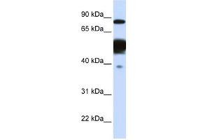 Nexilin antibody used at 1 ug/ml to detect target protein. (NEXN antibody)