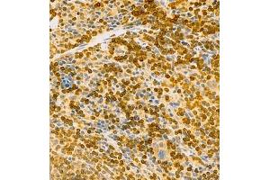 Immunohistochemistry (Paraffin-embedded Sections) (IHC (p)) image for anti-HLA-DR-gamma (CD74) antibody (ABIN7074245)