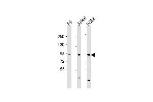 Western Blot at 1:2000 dilution Lane 1: F9 whole cell lysate Lane 2: Jurkat whole cell lysate Lane 3: K562 whole cell lysate Lysates/proteins at 20 ug per lane.