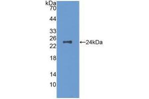 Western blot analysis of recombinant Mouse MCSF. (M-CSF/CSF1 antibody  (AA 33-204))
