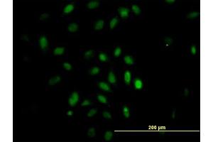 Immunofluorescence of monoclonal antibody to TRIM49 on HeLa cell. (TRIM49 antibody  (AA 251-340))