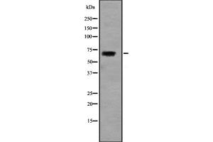 Western blot analysis of SLC5A5 expression in HEK293 cells (SLC5A5 antibody  (Internal Region))