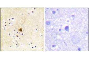 Immunohistochemistry analysis of paraffin-embedded human brain tissue, using RyR2 (Ab-2808) Antibody.
