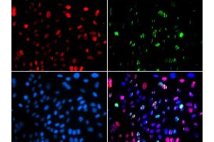 Immunofluorescence (IF) image for anti-Tumor Protein P53 (TP53) (pSer15) antibody (ABIN1870674) (p53 antibody  (pSer15))