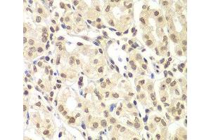 Immunohistochemistry of paraffin-embedded Human stomach using ULK4 Polyclonal Antibody at dilution of 1:100 (40x lens). (ULK4 antibody)