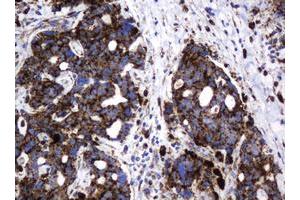 Image no. 2 for anti-Galactosidase, beta 1 (GLB1) antibody (ABIN1498467) (GLB1 antibody)