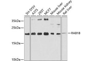 Western blot analysis of extracts of various cell lines, using R antibody (ABIN3016760, ABIN3016761, ABIN3016762 and ABIN6219834) at 1:1000 dilution. (RAB18 antibody  (AA 1-206))