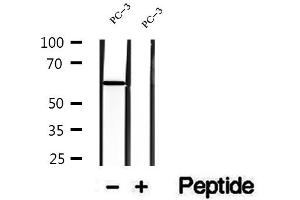 Western blot analysis of extracts of PC-3 cells, using DPP4 antibody. (DPP4 antibody  (C-Term))