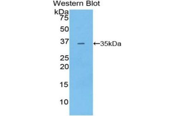 PDK4 antibody  (AA 117-387)