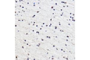 Immunohistochemistry of paraffin-embedded Rat brain using GTF3C3 Rabbit pAb (ABIN7267374) at dilution of 1:100 (40x lens). (GTF3C3 antibody)