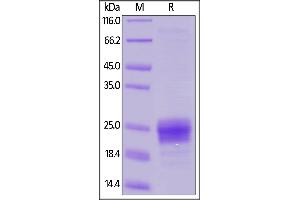 SDS-PAGE (SDS) image for Fms-Related tyrosine Kinase 3 Ligand (FLT3LG) (AA 27-185) protein (His tag) (ABIN6253536)