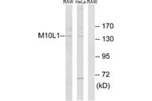 Western blot analysis of extracts from HeLa/RAW264. (MOV10L1 antibody  (AA 318-367))