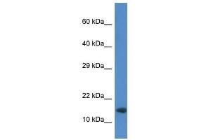 Western Blot showing Rnf122 antibody used at a concentration of 1. (RNF122 antibody  (Middle Region))