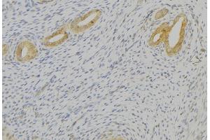 ABIN6276804 at 1/100 staining Human uterus tissue by IHC-P.