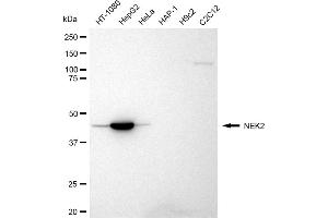 Western blotting analysis using NEK2 antibody (ABIN7799602).