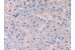 Used in DAB staining on fromalin fixed paraffin-embedded Spleen tissue (HPSE antibody  (AA 54-278))