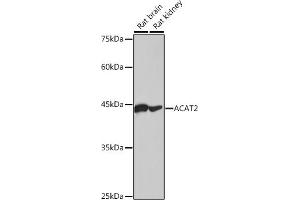 Western blot analysis of extracts of various cell lines, using  antibody (ABIN7265364) at 1:1000 dilution. (ACAT2 antibody)