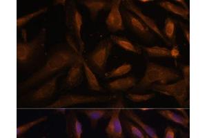 Immunofluorescence analysis of U-2 OS cells using UFC1 Polyclonal Antibody at dilution of 1:100 (40x lens). (UFC1 antibody)