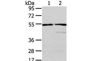 Western Blot analysis of Human normal liver and fetal liver tissue using ALDH3A2 Polyclonal Antibody at dilution of 1/250 (ALDH3A2 antibody)