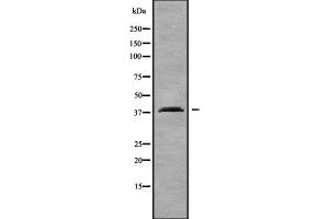 Western blot analysis OR2T4 using COLO205 whole cell lysates (OR2T4 antibody)