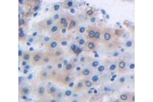 Figure. (Lectin, Galactose Binding, Soluble 5 (LGALS5) (AA 1-145) antibody)