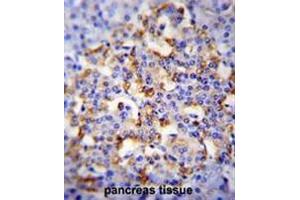 Immunohistochemistry (Paraffin-embedded Sections) (IHC (p)) image for anti-Chromogranin A (CHGA) (AA 383-412), (C-Term) antibody (ABIN951517)