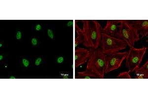 ICC/IF Image GABPA antibody [N2C2], Internal detects GABPA protein at nucleus by immunofluorescent analysis. (GABPA antibody  (Internal Region))
