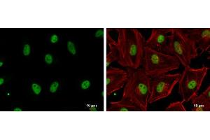ICC/IF Image GABPA antibody [N2C2], Internal detects GABPA protein at nucleus by immunofluorescent analysis.
