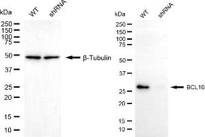 Western blotting analysis using BCL10 antibody (ABIN7797715). (BCL10 antibody)
