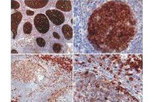 Immunohistochemistry staining (paraffin - embedded sections) using PAG1 monoclonal antibody, clone MEM - 255 . (PAG1 antibody  (AA 97-432))