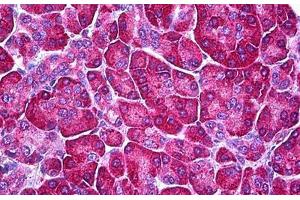 Human Pancreas: Formalin-Fixed, Parraffin-Embedded (FFPE) (Ferredoxin Reductase antibody)