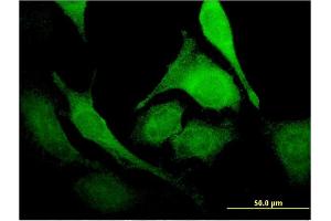 Immunofluorescence of monoclonal antibody to PUS1 on HeLa cell. (PUS1 antibody  (AA 1-399))